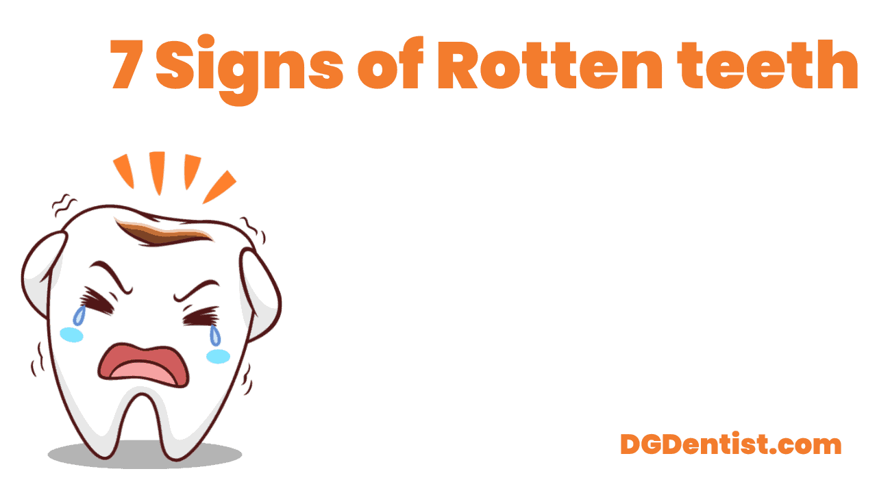 7 signs of rotten teeth featured image