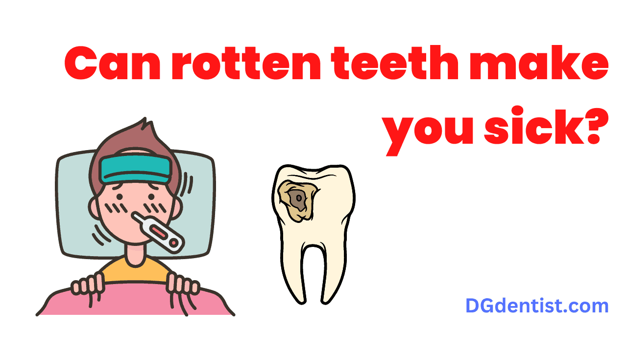 Can rotten teeth make you sick featured image