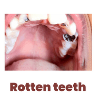 rotten teeth graphical image