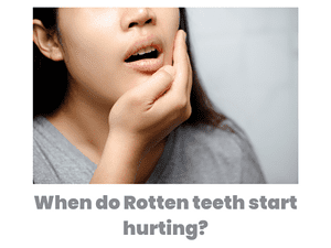 woman holding her mouth due to rotten teeth pain