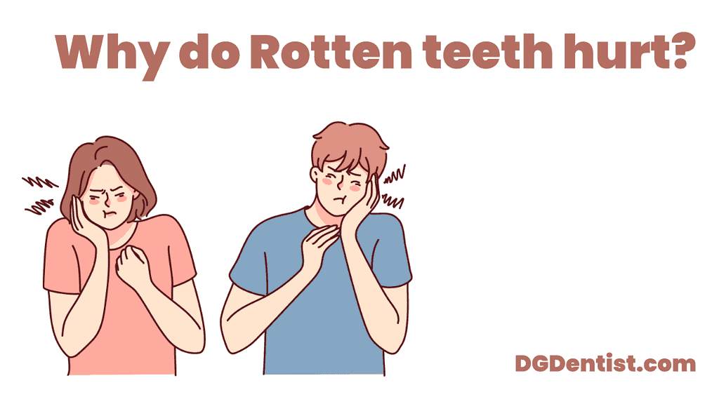 Rotten Teeth Causes, Symptoms & Treatment DG Dentist