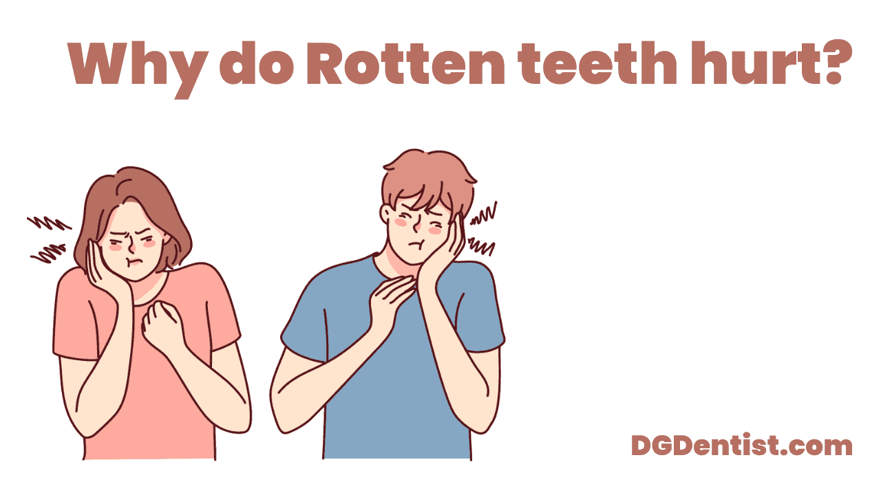 Why do Rotten teeth hurt featured image