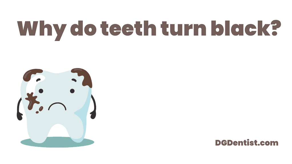 Why do teeth turn black featured image