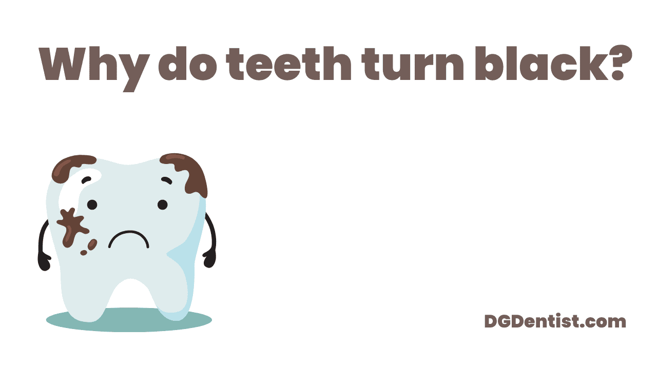 Why Do Teeth Turn Black 6 Reasons Behind It DG Dentist Why Do Teeth Turn Black 6 Reasons Behind It DG Dentist