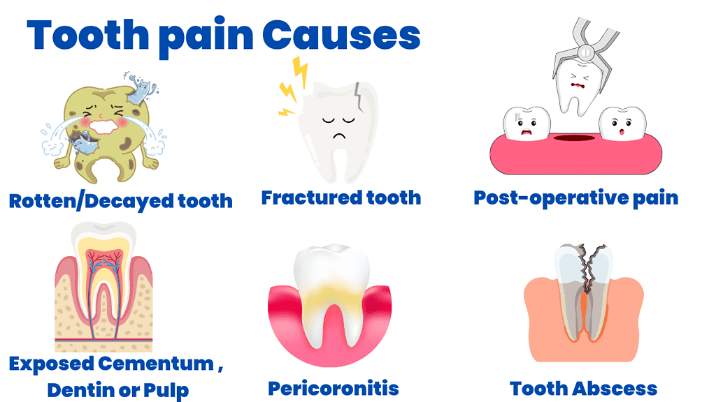 Causes of unbearable tooth pain