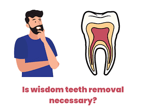 graphical image showing a man thinking is wisdom teeth removal necessary or not?