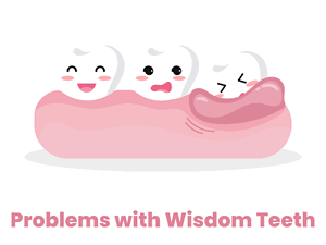graphical image showing an impacted wisdom tooth