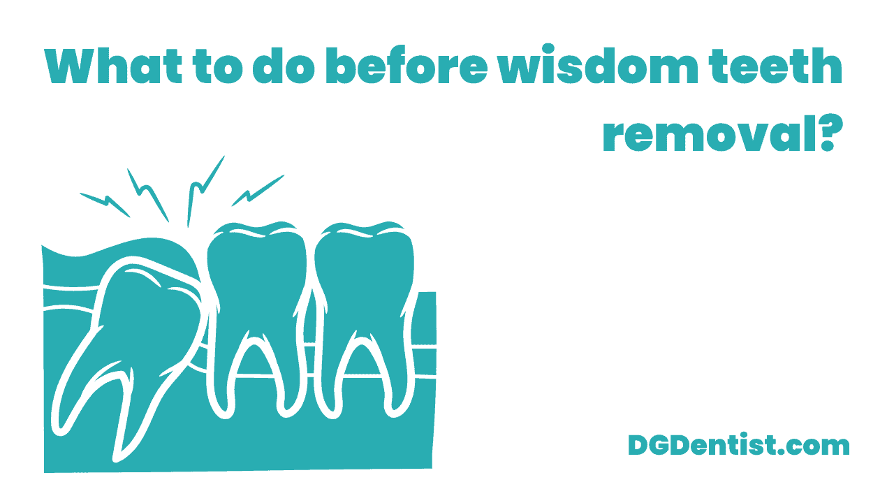 What to do before wisdom teeth removal featured image